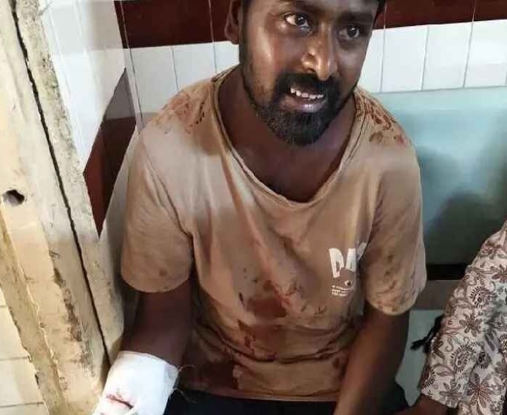 అద్దం పగిలి ఓ వ్యక్తికి తీవ్రగాయాలు