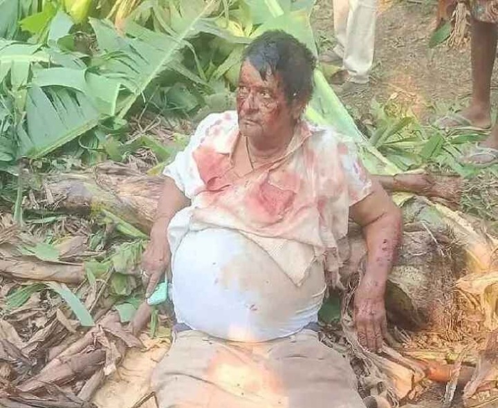 కారు అదుపుతప్పి వ్యక్తికి తీవ్ర గాయాలు