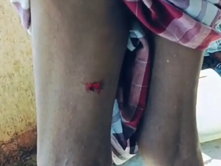 వీధి కుక్కల దాడులు.. ఇద్దరికి గాయాలు