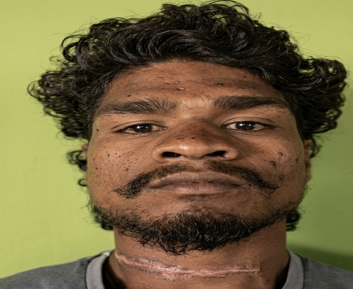 ఇటుకల పండుగలో తృటిలో తప్పిన ప్రమాదం