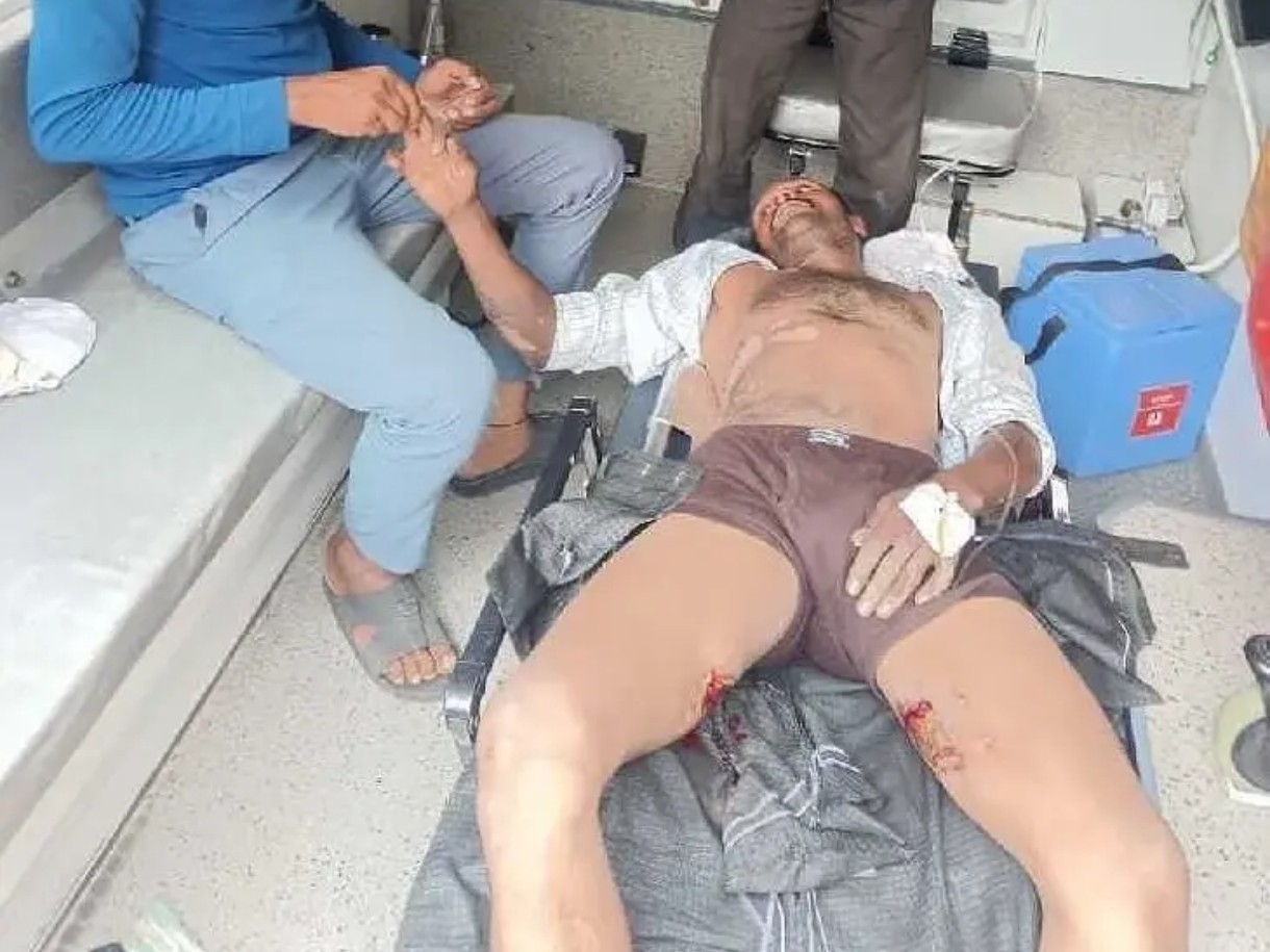 విద్యుత్ షాక్‌తో వ్యక్తికి తీవ్ర గాయాలు!