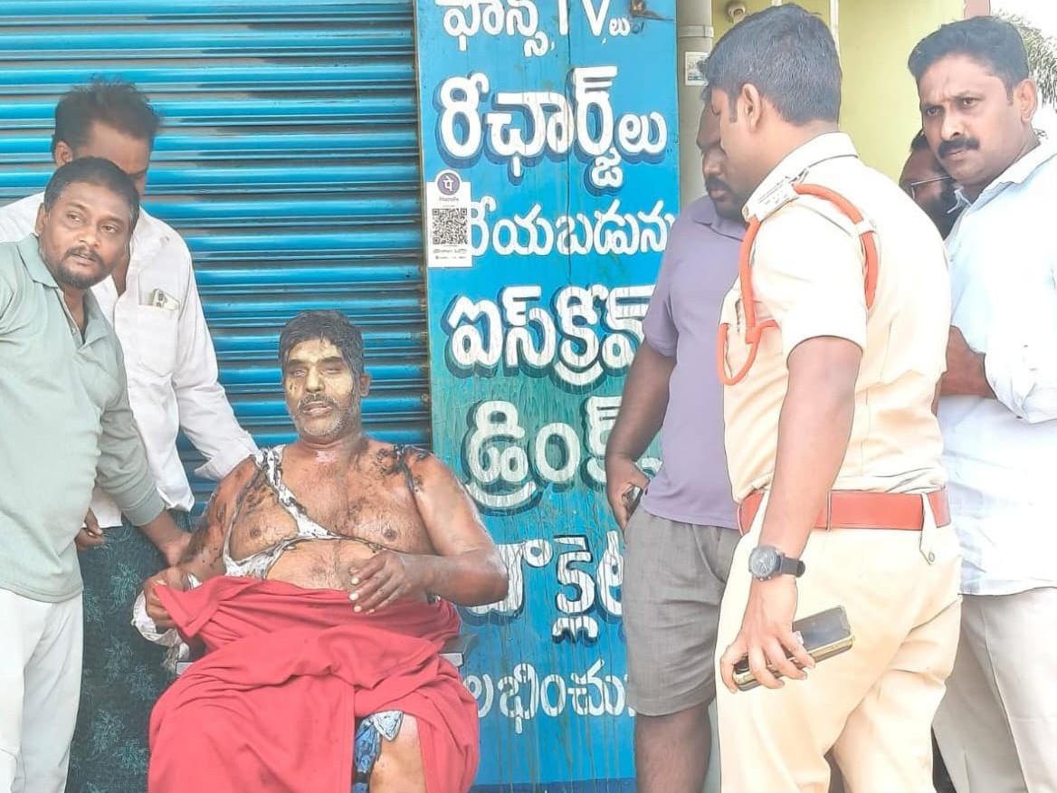 ఆస్తి వివాదం.. వ్యక్తిపై యాసిడ్ దాడి.!