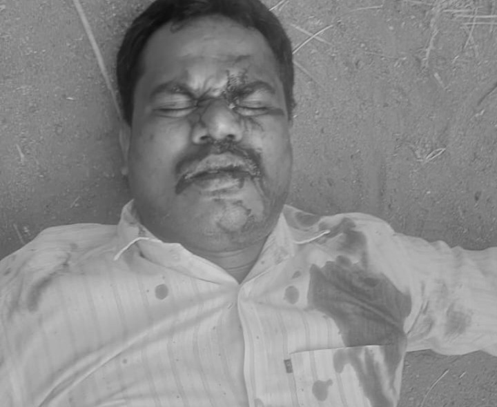 జమాండ్లపల్లి వద్ద బైక్ ఆటో ఢీ.. ఒకరికి గాయాలు