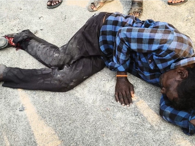 లారీ ఢీకొని వ్యక్తికి తీవ్ర గాయాలు..!