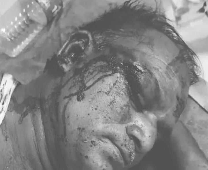 వ్యక్తిపై గొడ్డలితో దాడి.. పరిస్ధితి విషమం