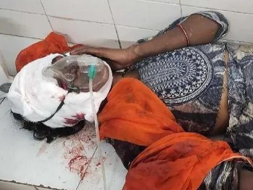 ట్రాక్టర్‌పై దంపతుల ఘర్షణ.. మహిళకు తీవ్ర గాయాలు