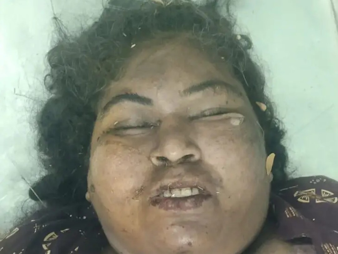 గుర్తుతెలియని మహిళ మృతి