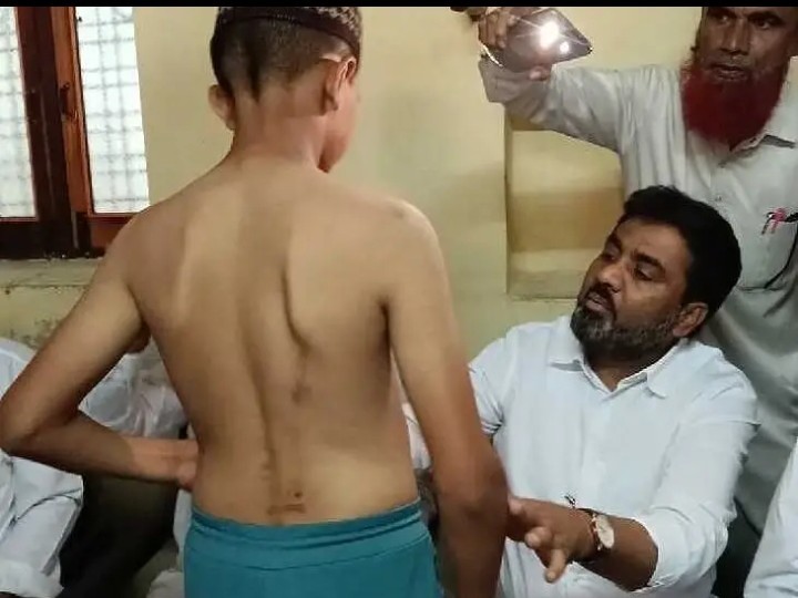 విద్యార్థిని పరామర్శించిన నేతలు