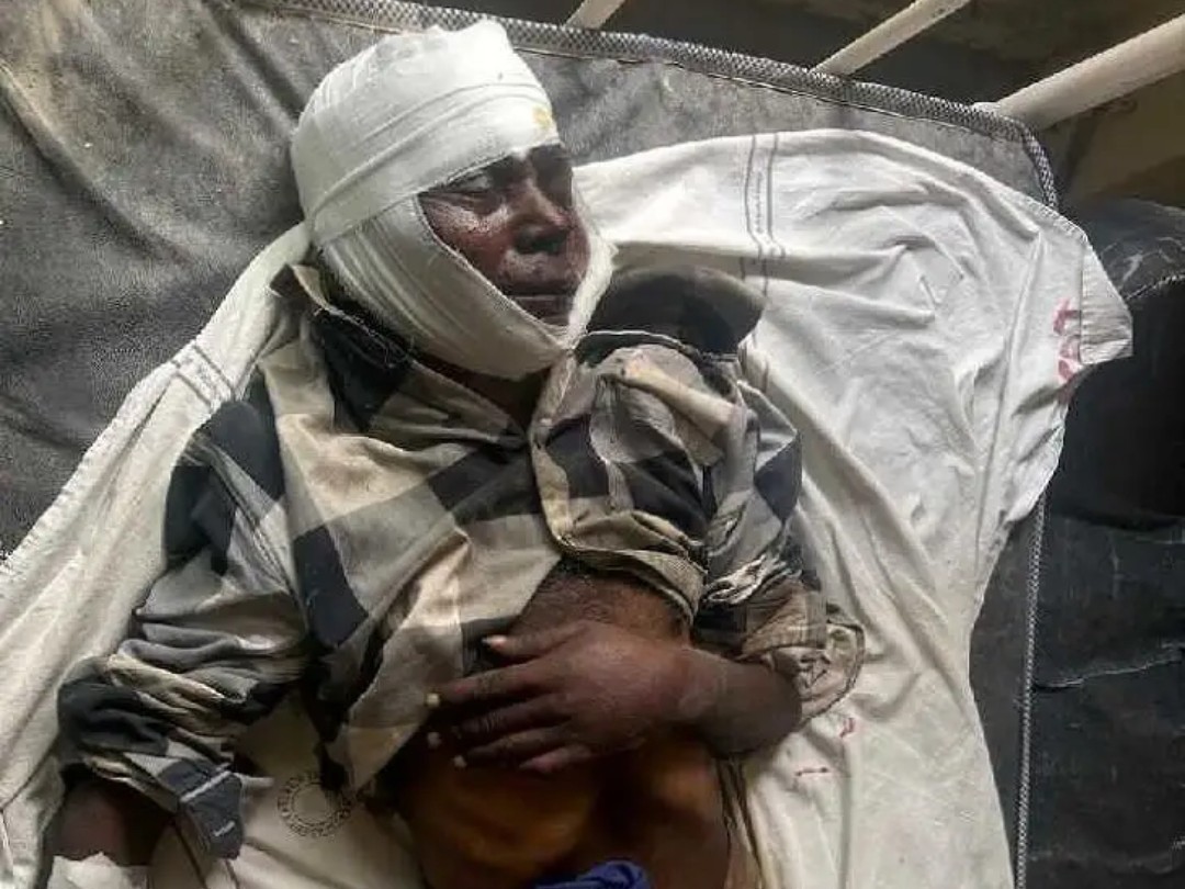 MBNR:రోడ్డు ప్రమాదం.. వ్యక్తికి తీవ్ర గాయాలు