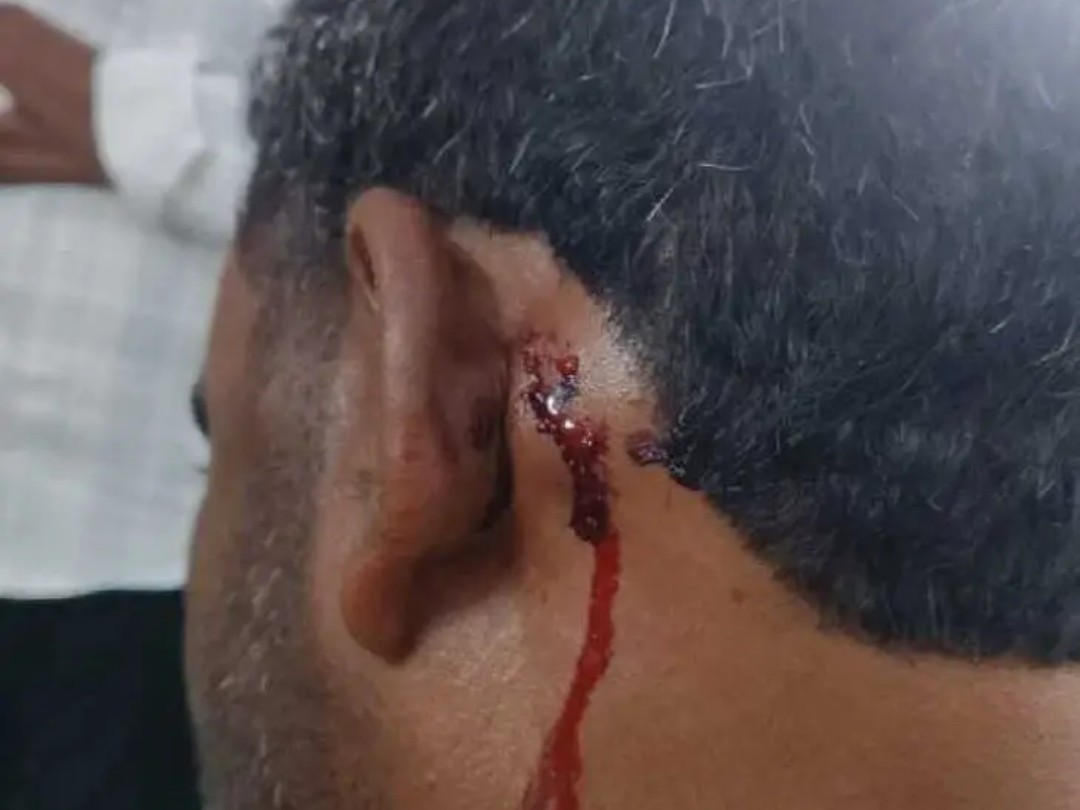 భూవివాదం.. ఉపసర్పంచ్‌పై దాడి