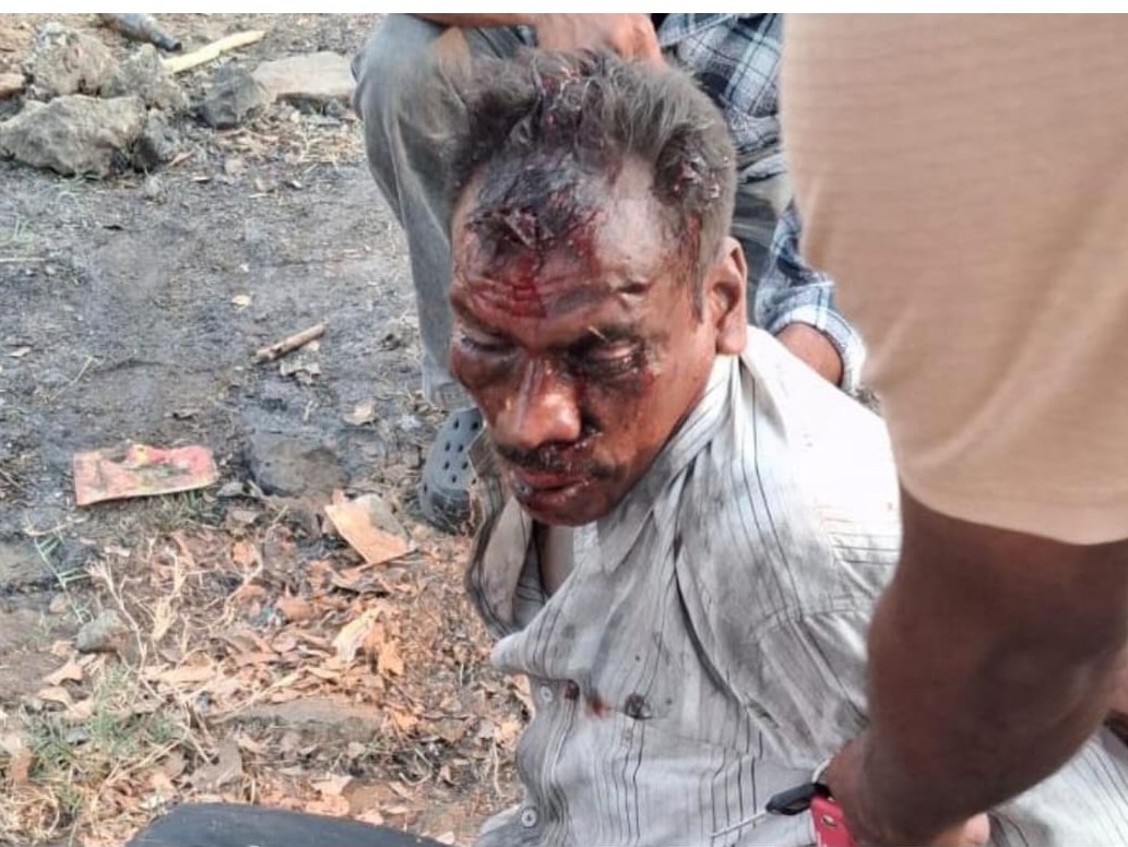 రోడ్డు ప్రమాదంలో ఓ వ్యక్తికి తీవ్ర గాయాలు