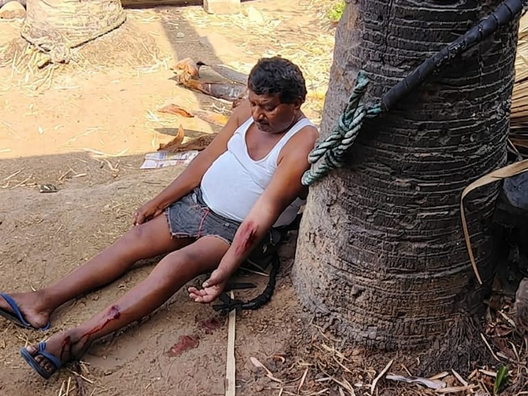 తాటి చెట్టుపై నుంచి పడి గీత కార్మికునికి గాయాలు