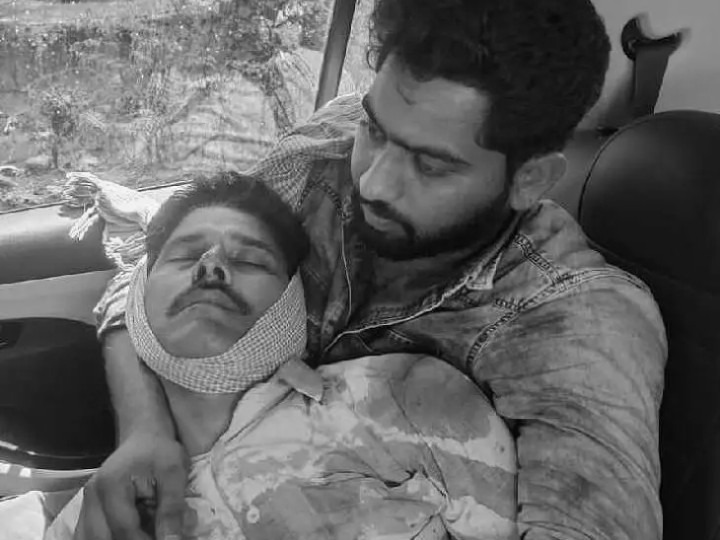 కోతుల  దాడిలో కాంగ్రెస్ నాయకుడు మృతి