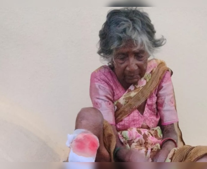 కుక్క కాటుకు గురైన వృద్ధురాలి మృతి