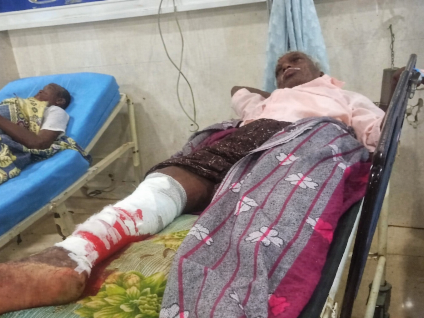 తాడిచెట్టు పైనుంచి జారిపడి గీత కార్మికుడికి గాయాలు