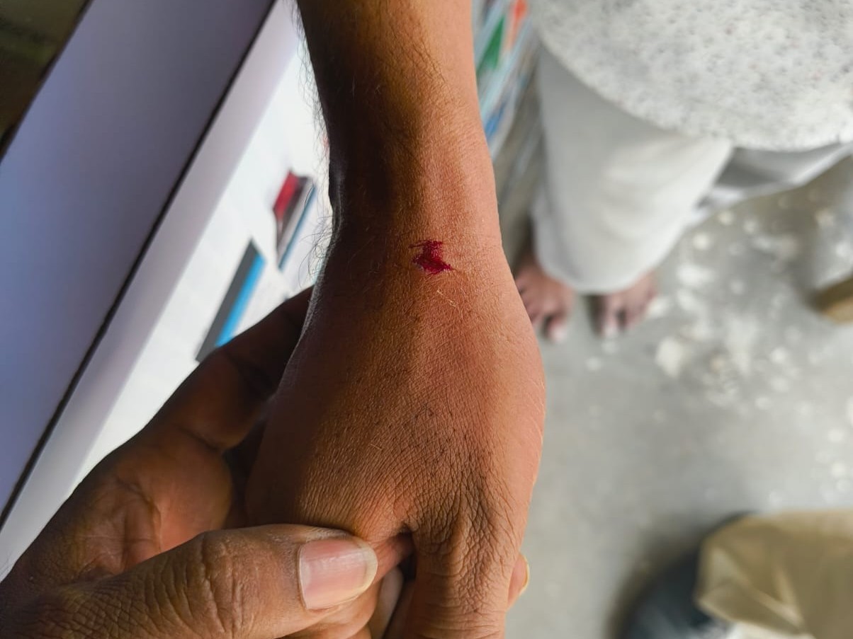 బిచ్చం తక్కువగా ఇచ్చాడని వ్యక్తిపై దాడి