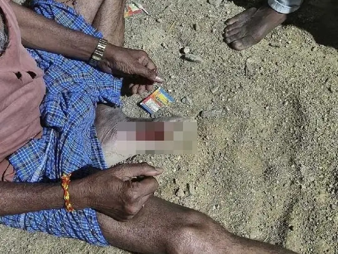 వీధి కుక్కల దాడిలో ఓ వ్యక్తికి గాయం