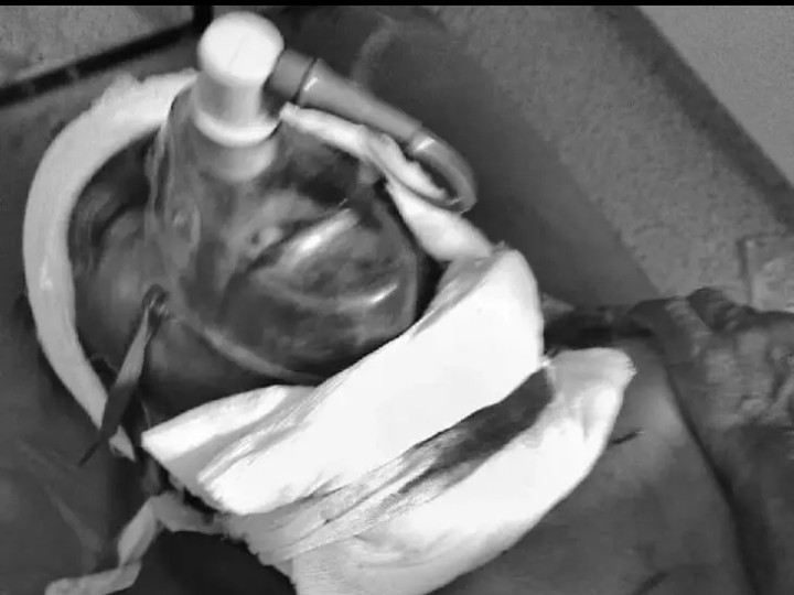 గొడ్డలితో దాడి.. వ్యక్తికి తీవ్ర గాయాలు