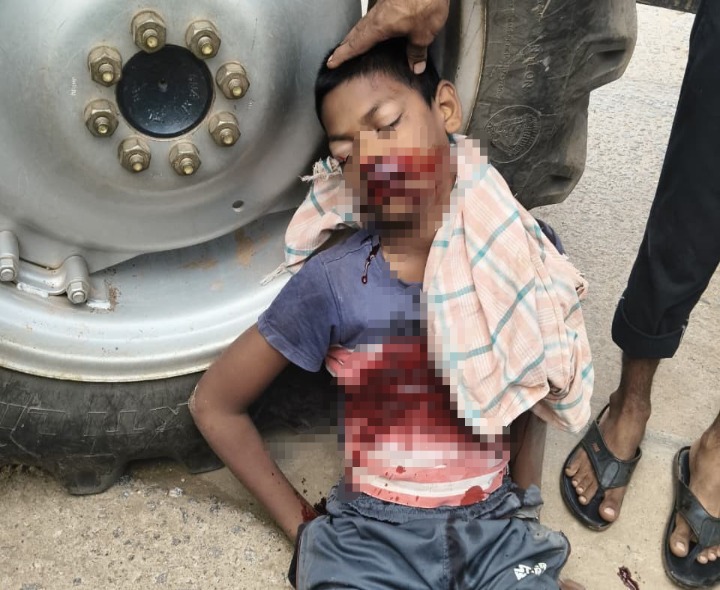 సైకిల్‌ను ఢీకొన్న ట్రాక్టర్, బాలుడి పరిస్థితి విషమం