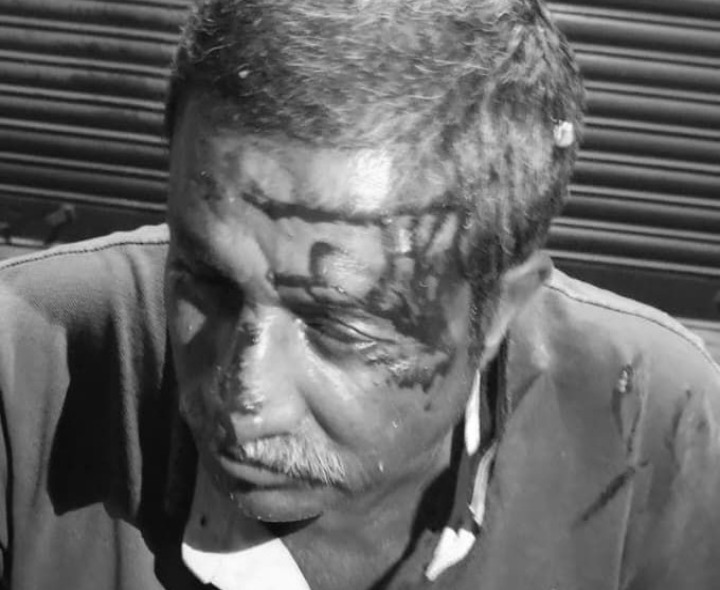 రోడ్డుపై మొక్కజొన్నలు.. ఓ వ్యక్తికి గాయాలు