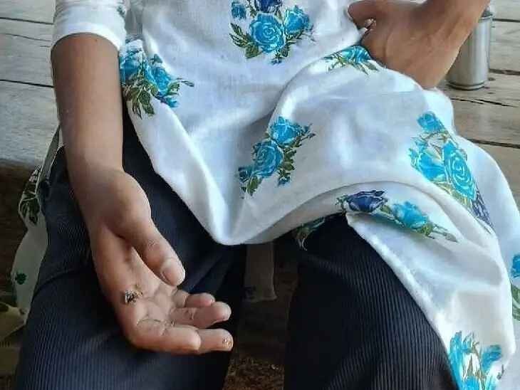 షాక్‌కు గురై బాలికకు గాయాలు