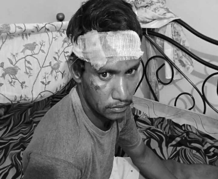 కోతుల దాడి.. యువకుడికి గాయాలు