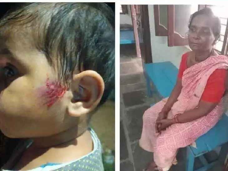 హుజూర్ నగర్‌లో వీధి కుక్కల బెడద