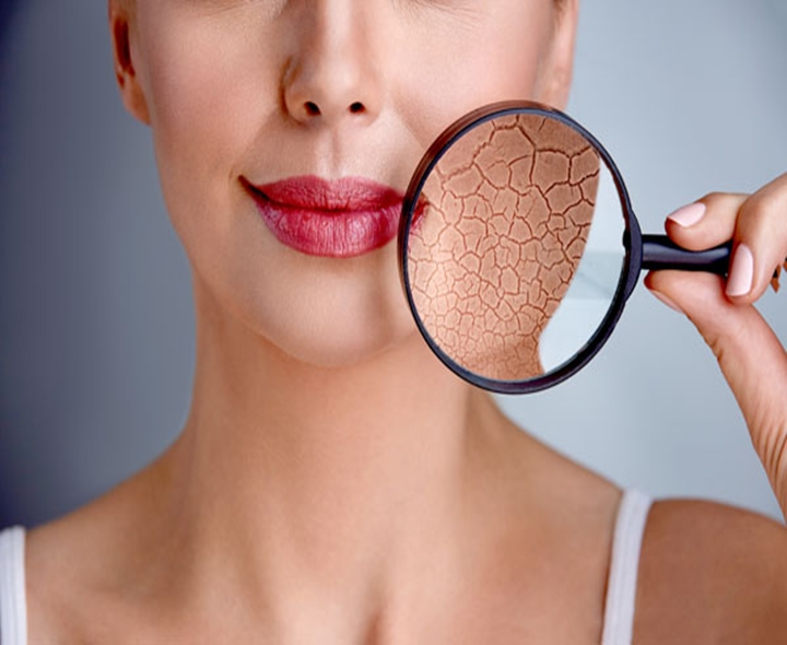 వేసవిలోనూ చర్మం పొడిబారుతుందా?