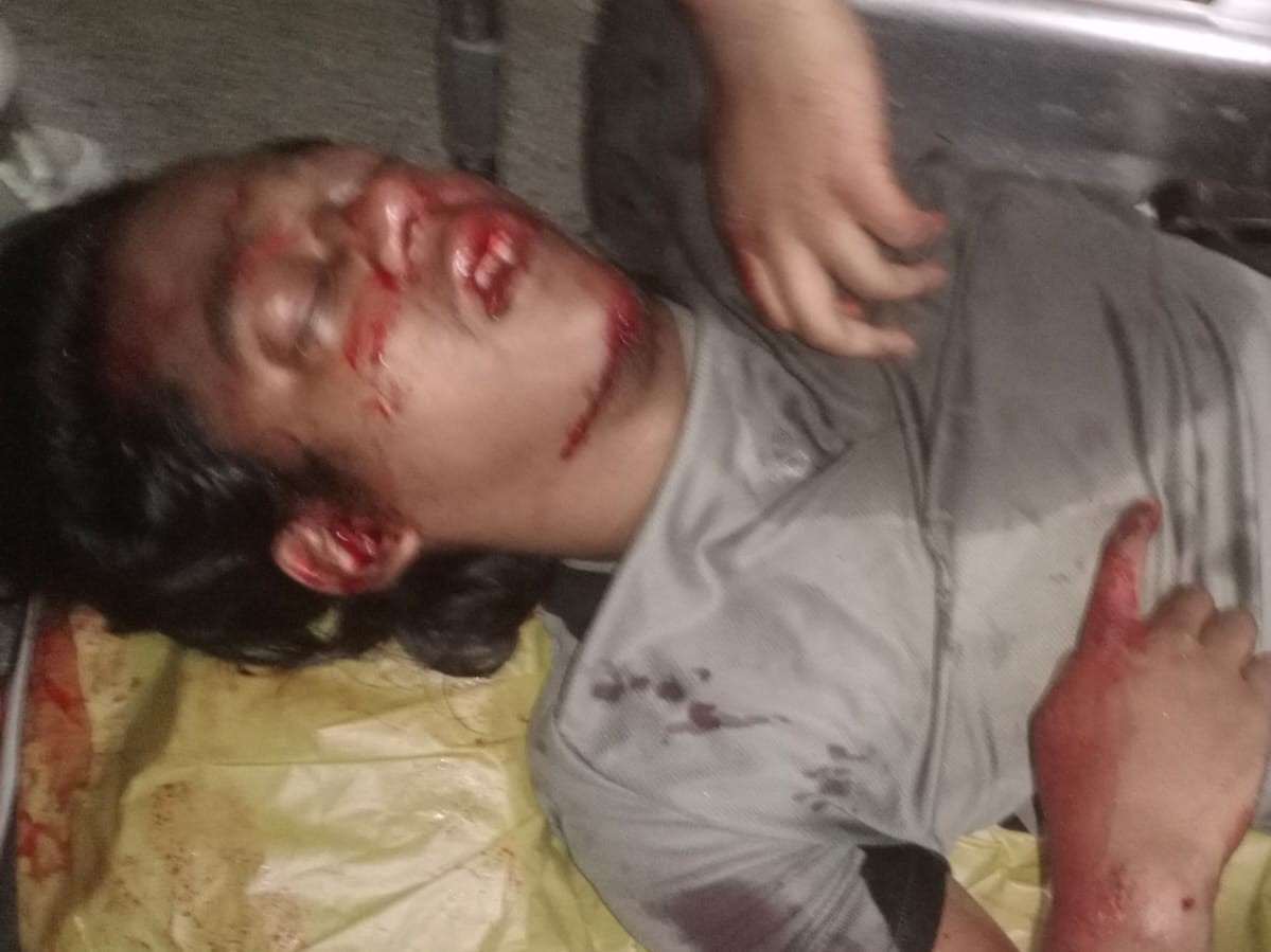 వరంగల్‌లో రోడ్డు ప్రమాదం.. పీజీ విద్యార్థికి గాయాలు