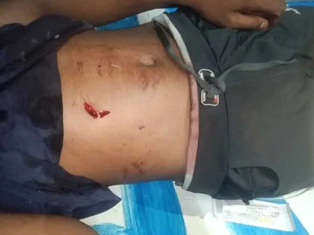 మైలార్‌దేవ్ పల్లిలో రౌడీ షీటర్ హల్‌చల్