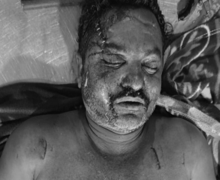 రోడ్డు ప్రమాదంలో సూర్యాపేట వ్యక్తి మృతి