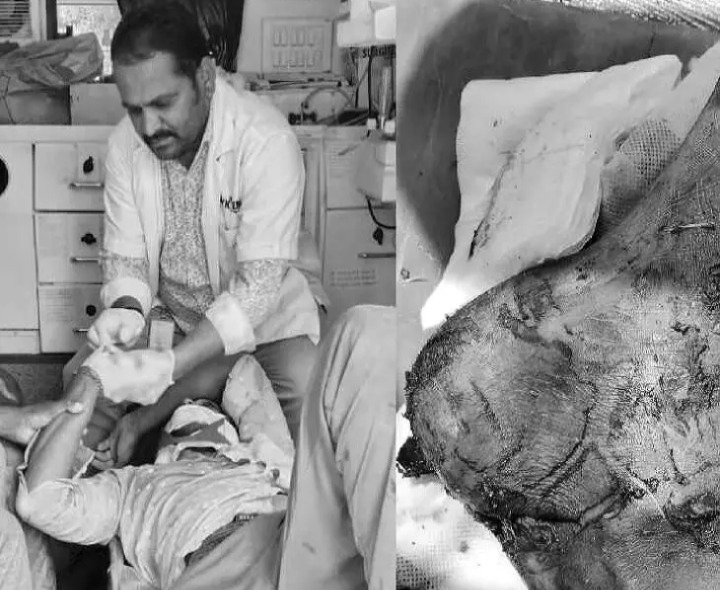 ట్రాక్టర్ ఢీకొని యువకుడికి తీవ్ర గాయాలు