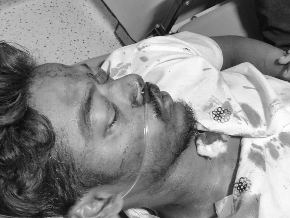 ఎదురెదురుగా ఢీకొన్న బైక్ లు.. ఇద్దరికి గాయాలు