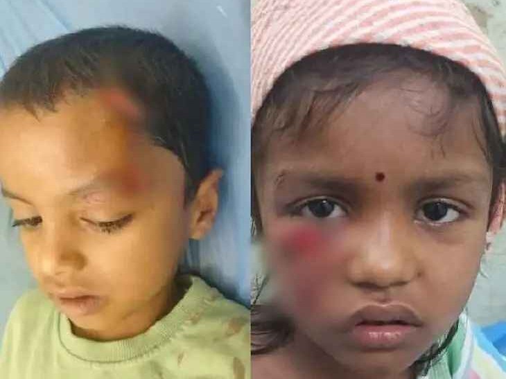 వేరు వేరు ప్రాంతాల్లో పిచ్చి కుక్కలు దాడి