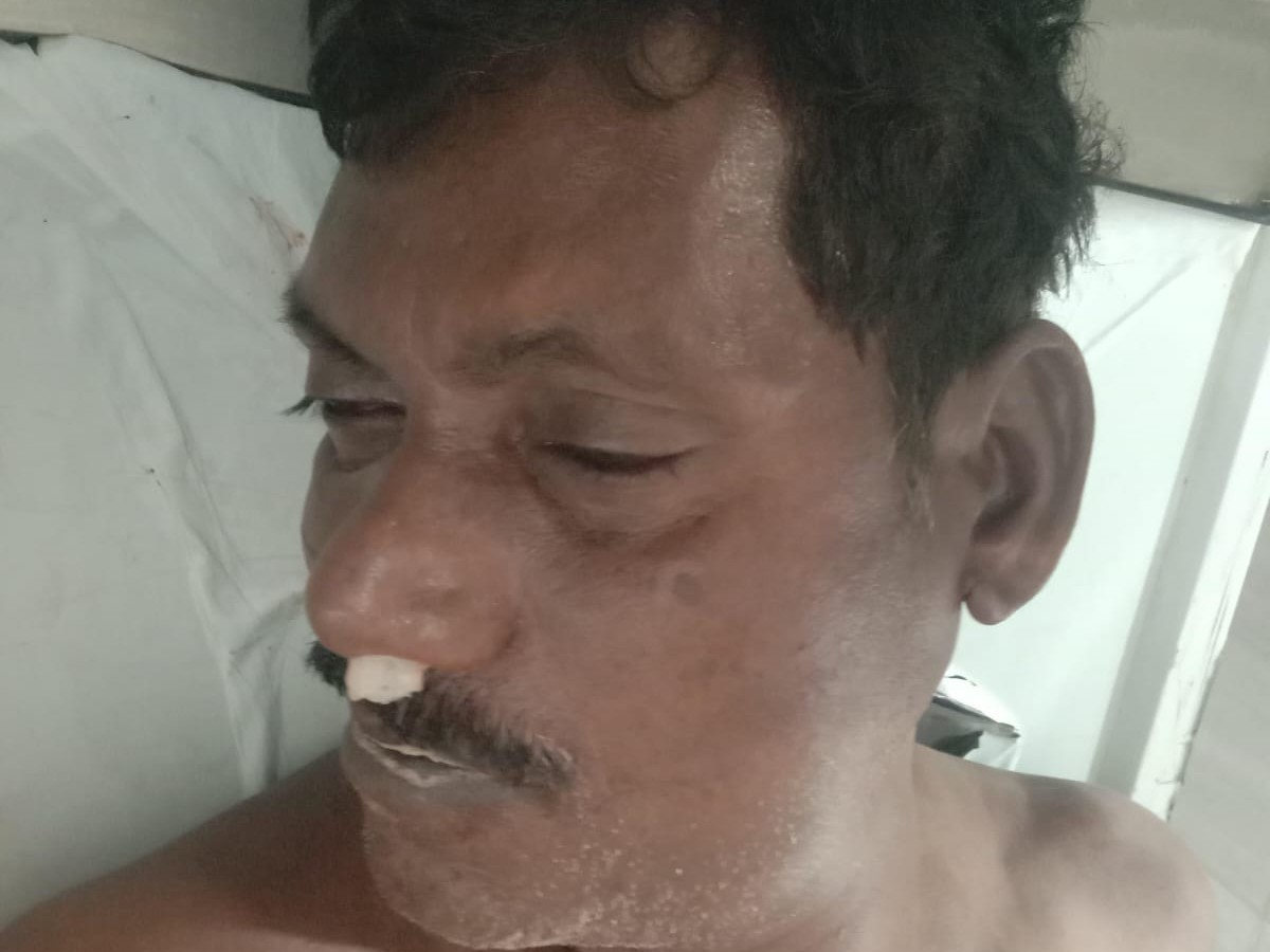 చేపలు పట్టే క్రమంలో ఒకరి మృతి