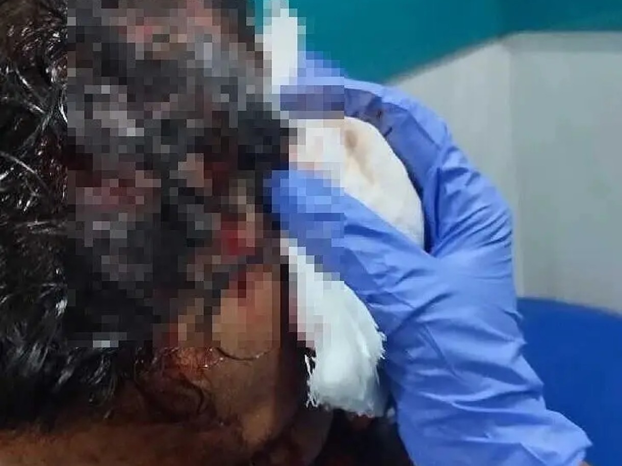 రూ. 10 కర్రీ రాదంటే.. కత్తిపోట్లు..!