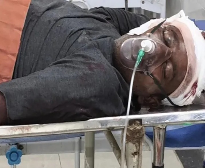 గుర్తుతెలియని వాహనం ఢీకొని వ్యక్తికి తీవ్ర గాయాలు