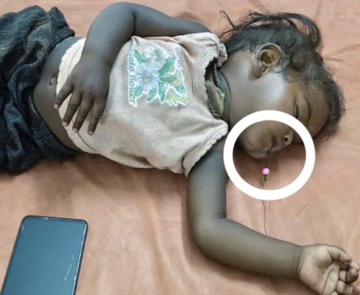 చేపల గాలాన్ని నోటిలో గుచ్చుకున్న బాలిక