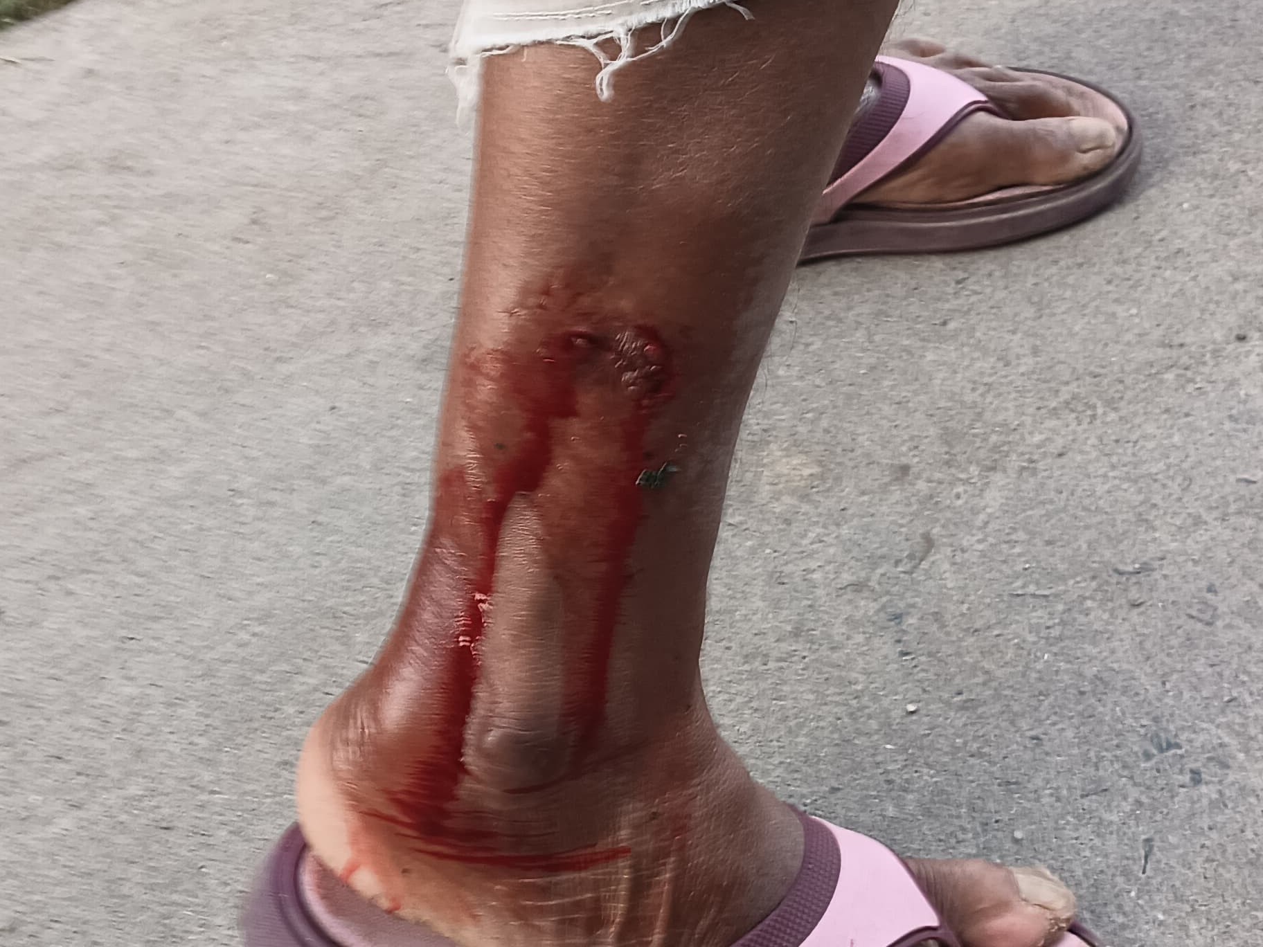 వీధి కుక్క దాడి.. మహిళకు గాయాలు!