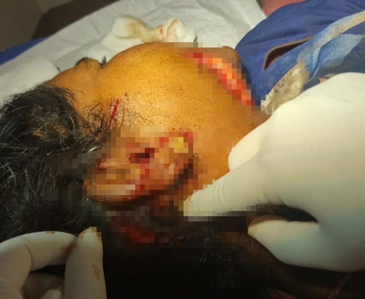 మహిళపై ఎలుగుబంటి దాడి