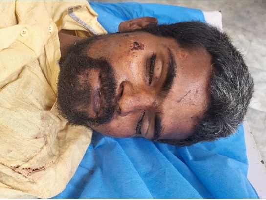 వడదెబ్బతో మతిస్థిమితం లేని వ్యక్తి మృతి