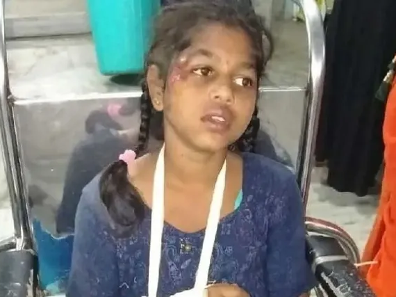 మిద్దెపై నుంచి జారిపడి బాలికకు తీవ్ర గాయాలు