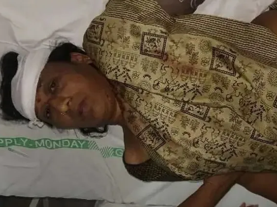 ఆర్టీసీ బస్సు నుంచి పడి మహిళకు తీవ్ర గాయాలు