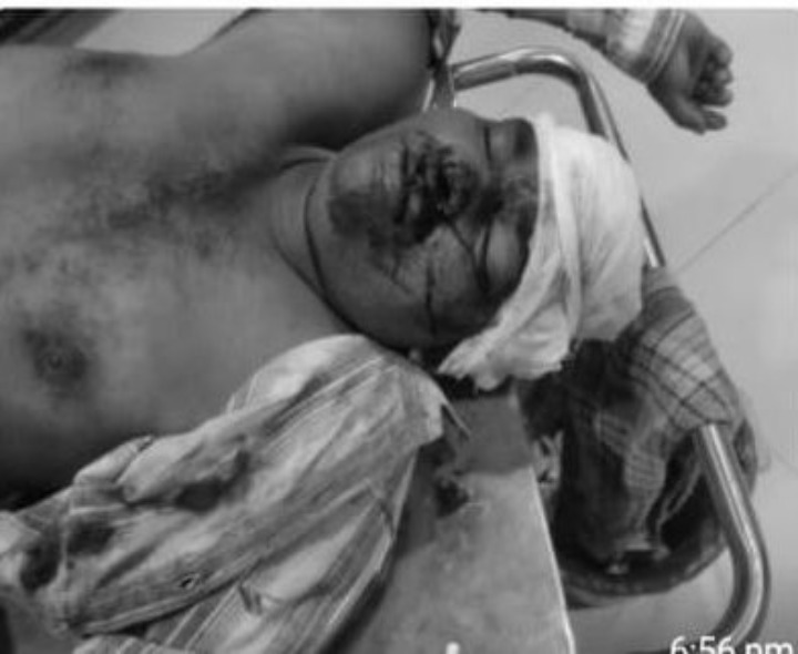 వేపలగడ్డ సమీపంలో రోడ్డు ప్రమాదం