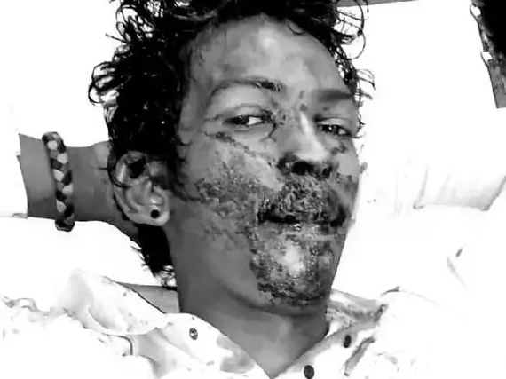 విద్యుత్ దీపాల అలంకరణ.. యువకుడికి గాయాలు