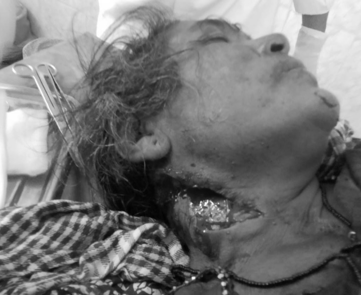 గిరిజన మహిళపై కత్తితో దాడి