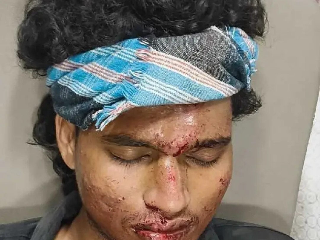 అద్దంకిలో బైక్ ప్రమాదం.. యువకుడికి గాయాలు