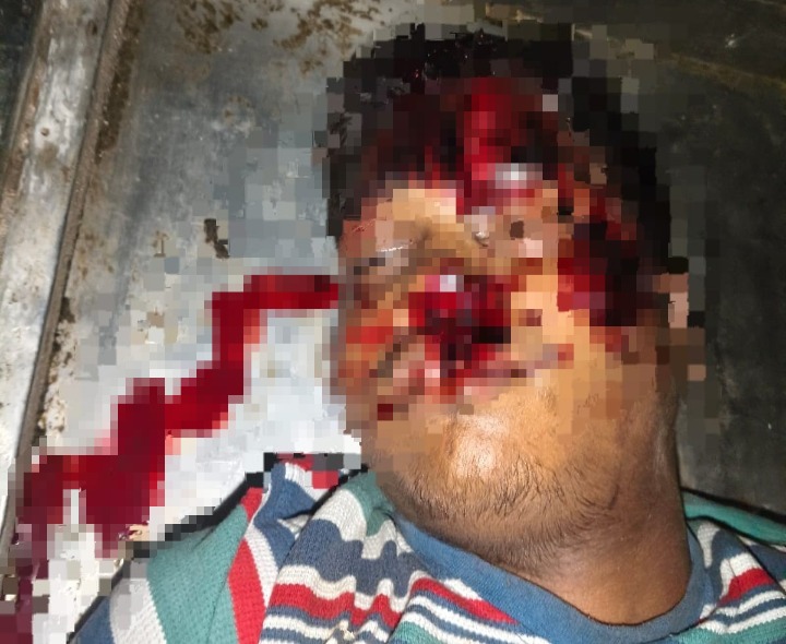 ఆగి ఉన్న లారీని ఢీకొన్న బైక్.. యువకుడి మృతి