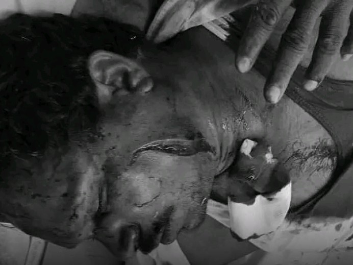అప్పు తీర్చమంటే.. కర్రలతో దాడి..!